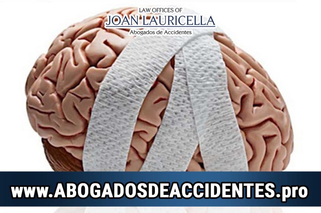 Abogados de Accidentes de Trabajo y Auto en Los Angeles California