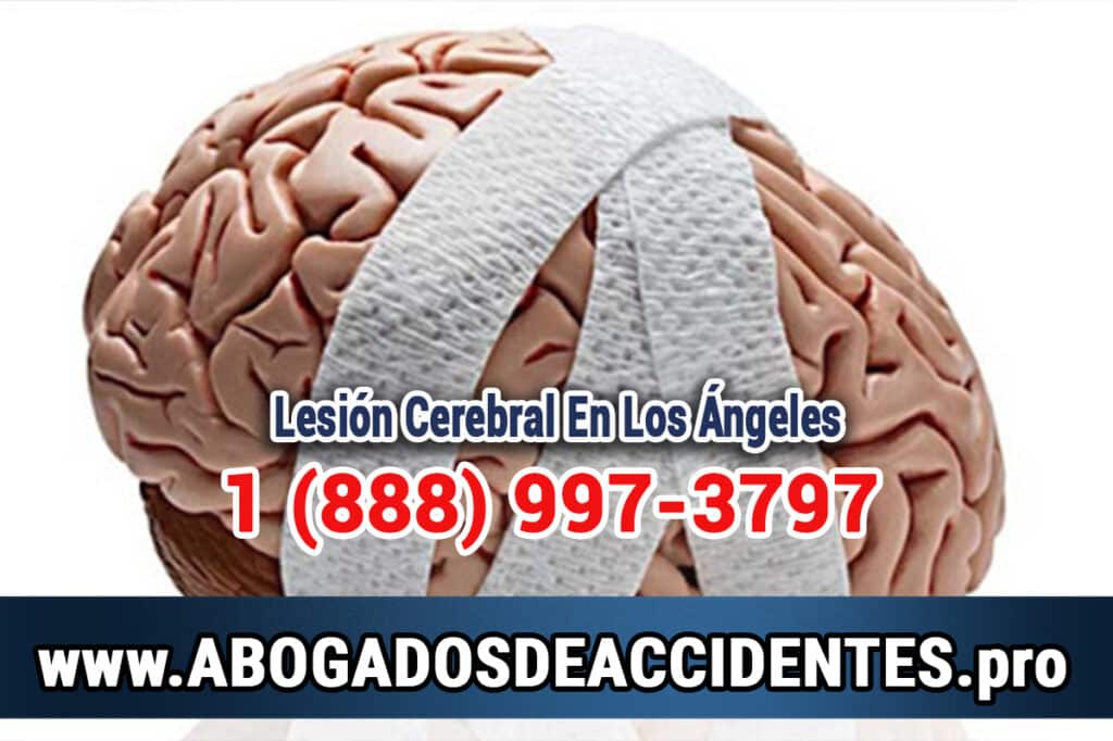 Abogados de Accidentes en Los Ángeles